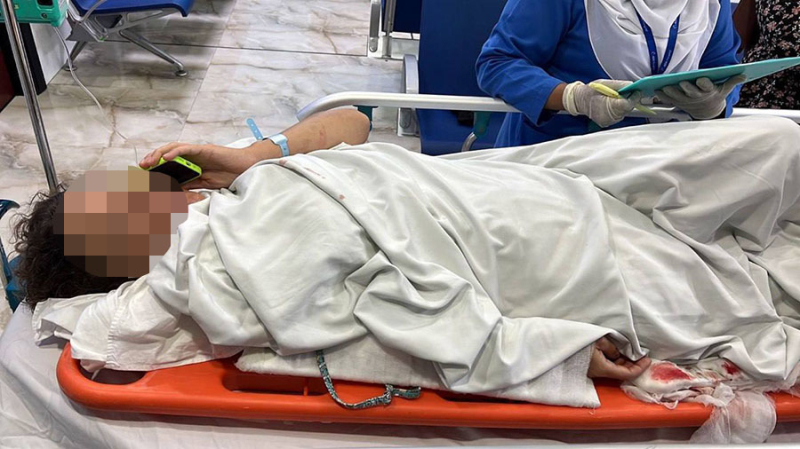 «Увидела, что плаваю в огромном пятне крови»: россиянка рассказала о травмах после попадания под катер на Мальдивах
