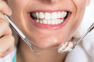 Реставрация зубов: восстановление улыбки и здоровья